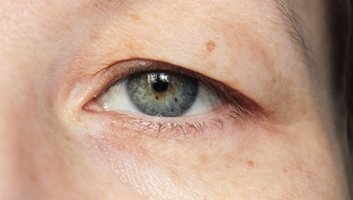 Operacija kapaka Turska