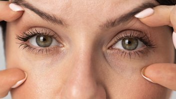 Operacija blefaroplastike Turska