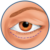 Fox eyes Турска
