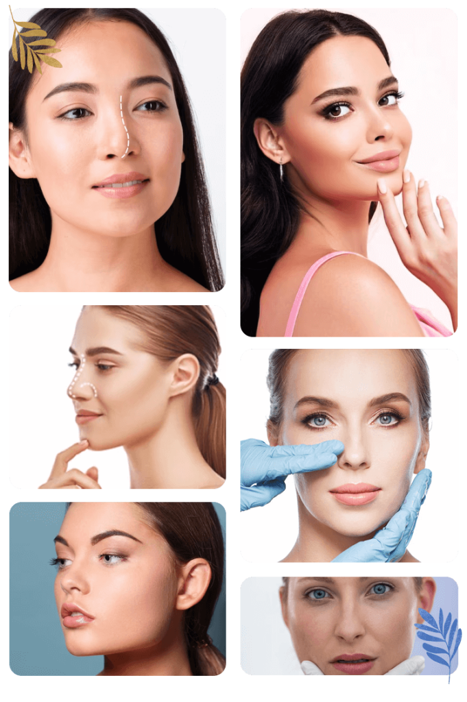 Tipovi revizione rinoplastike