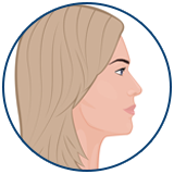 Liposukcija podbratka u Turskoj