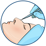 Neoperativna rinoplastika Turska