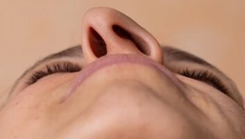 Devijacija nosnog septuma