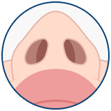 Operacija devijacije septuma Turska