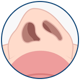 Operacija devijacije septuma Turska