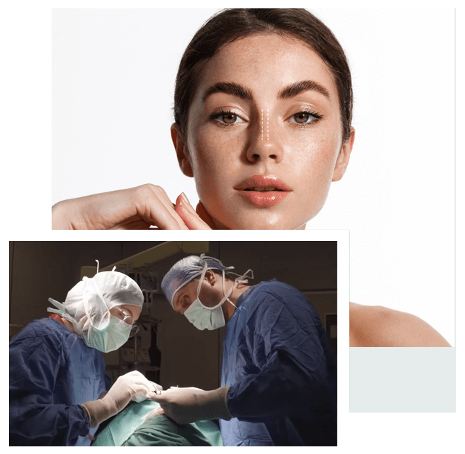 šta-je-operacija-devijacije-septuma