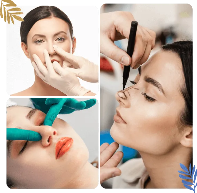 Operacija devijacije septuma u Istanbulu