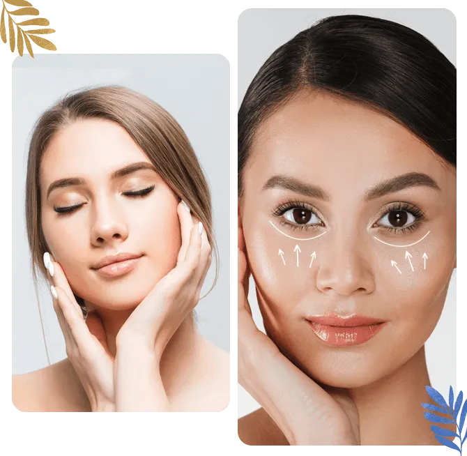 tipovi-blefaroplastike