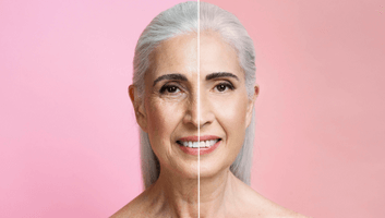 koje-metode-se-koriste-u-kozmetičkom-podizanju-lica