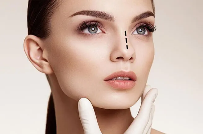 Reviziona rinoplastika