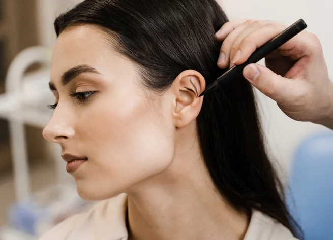 Stvari koje treba razmotriti pre otoplastike procedure