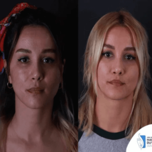 podizanje-usana-zene-u-turskoj