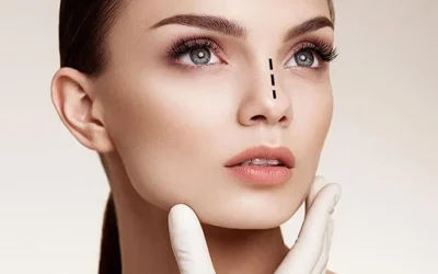 Rinoplastika u Turskoj