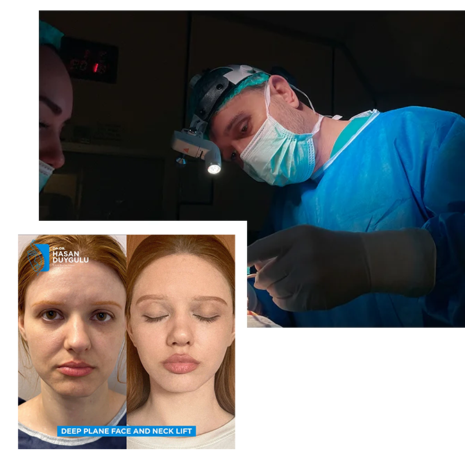 Face lift in Turkey