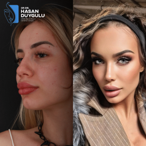 hirurg-rinoplastike-turska